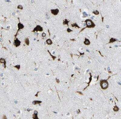 Immunohistochemistry-Paraffin: G3BP2 Antibody [NBP1-82976] - Staining of human cerebral cortex shows strong cytoplasmic positivity in neuronal cells.