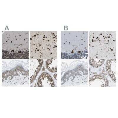 <b>Independent Antibodies Validation and Orthogonal Strategies Validation.</b>Immunohistochemistry-Paraffin: G3BP2 Antibody [NBP1-82977] - Staining of human cerebellum, cerebral cortex, skin and testis using Anti-G3BP2 antibody NBP1-82977 (A) shows similar protein distribution across tissues to independent antibody NBP1-82976 (B).