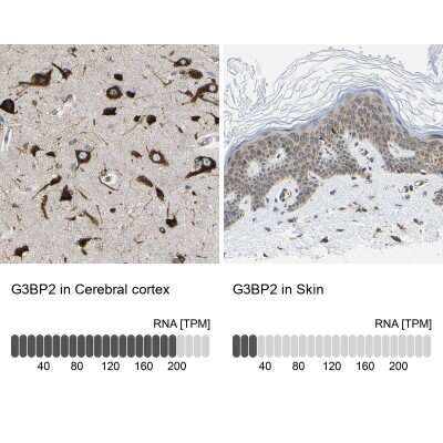 Immunohistochemistry-Paraffin G3BP2 Antibody