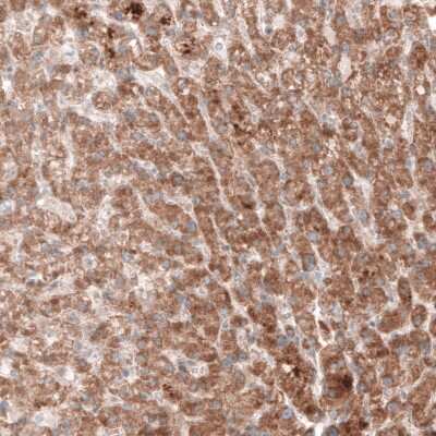 Immunohistochemistry-Paraffin: G6PC Antibody (CL5817) [NBP2-61432] - Staining of human liver shows moderate cytoplasmic immunoreactivity in hepatocytes.