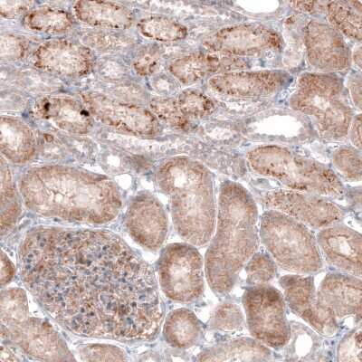 Immunohistochemistry-Paraffin: G6PC Antibody (CL5817) [NBP2-61432] - Staining of human kidney shows moderate cytoplasmic immunoreactivity in renal tubules and in glomerulus.