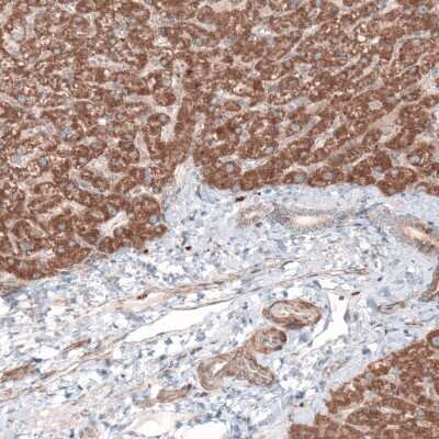 Immunohistochemistry-Paraffin: G6PC Antibody (CL5818) [NBP2-61433] - Staining of human liver shows moderate cytoplasmic immunoreactivity in hepatocytes.