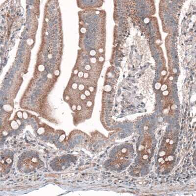 Immunohistochemistry-Paraffin: G6PC Antibody (CL5818) [NBP2-61433] - Staining of human duodenum shows cytoplasmic immunoreactivity in glandular cells.