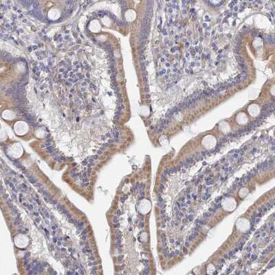 Immunohistochemistry-Paraffin: G6PC Antibody [NBP2-31916] - Staining of human duodenum shows moderate cytoplasmic positivity in glandular cells.