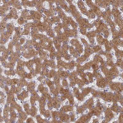 Immunohistochemistry-Paraffin: G6PC Antibody [NBP2-31916] - Staining of human liver shows moderate cytoplasmic positivity in hepatocytes.