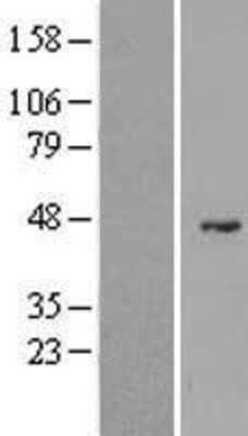 Western Blot: G6PC2 Overexpression Lysate (Adult Normal) [NBL1-10897] Left-Empty vector transfected control cell lysate (HEK293 cell lysate); Right -Over-expression Lysate for G6PC2.