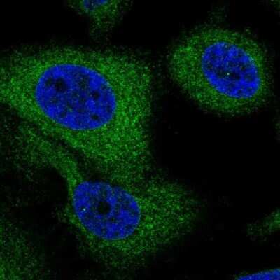 Immunocytochemistry/Immunofluorescence: G6PC3 Antibody [NBP2-57778] - Staining of human cell line PC-3 shows localization to endoplasmic reticulum. Antibody staining is shown in green. 