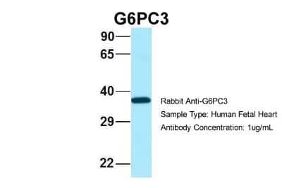 Western Blot: G6PC3 Antibody [NBP2-82857] - Host: Rabbit. Target Name: G6PC3. Sample Type: Human Fetal Heart. Antibody Dilution: 1.0ug/ml