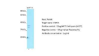 Western Blot: G6PC3 Antibody [NBP2-82857] - Host: Rabbit. Target: G6PC3. Positive control (+): MCF7 (N10). Negative control (-): Human Placenta (PL). Antibody concentration: 1ug/ml