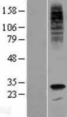 Western Blot: G6PC3 Overexpression Lysate (Adult Normal) [NBP2-05667] Left-Empty vector transfected control cell lysate (HEK293 cell lysate); Right -Over-expression Lysate for G6PC3.
