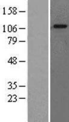 Western Blot: GAA Overexpression Lysate (Adult Normal) [NBL1-10901] Left-Empty vector transfected control cell lysate (HEK293 cell lysate); Right -Over-expression Lysate for GAA.