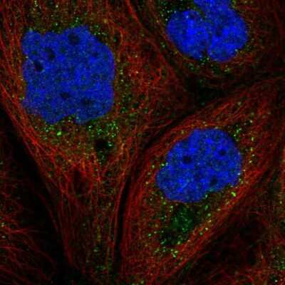 Immunocytochemistry/Immunofluorescence: GAB1 Antibody [NBP3-05522] - Staining of human cell line A-431 shows localization to vesicles.