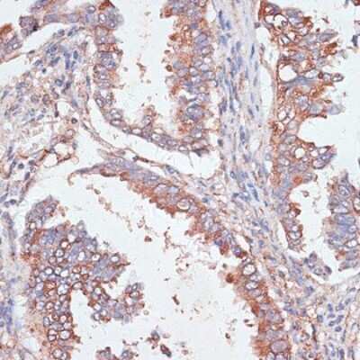 Immunohistochemistry-Paraffin GAB1 Antibody - Azide and BSA Free