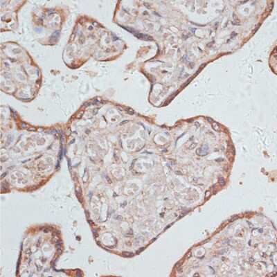 Immunohistochemistry-Paraffin: GAB1 Antibody [NBP3-04453] - Paraffin-embedded human placenta using GAB1 antibody at dilution of 1:100 (40x lens).