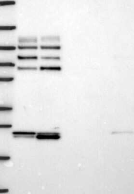 Western Blot GAB1 Antibody