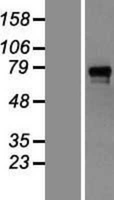 Western Blot GAB1 Overexpression Lysate