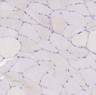 Immunohistochemistry-Paraffin: GAB2 Antibody [NBP1-81500] - Staining of human skeletal muscle shows no cytoplasmic positivity in myocytes as expected.