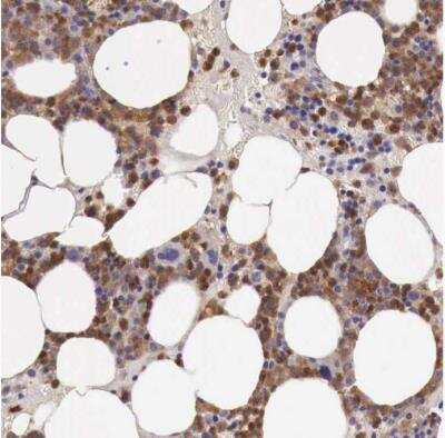 Immunohistochemistry-Paraffin GAB2 Antibody