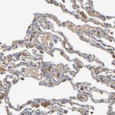 Immunohistochemistry-Paraffin: GAB3 Antibody [NBP1-86111] - Staining of human lung shows moderate membranous positivity in macrophages.