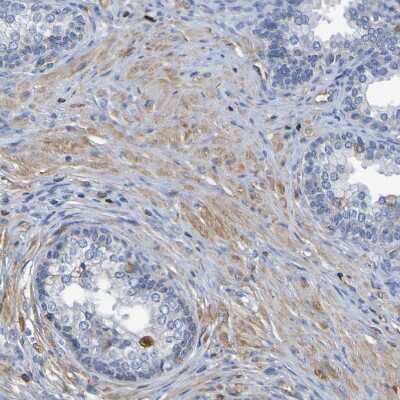 Immunohistochemistry-Paraffin: GAB3 Antibody [NBP1-86111] - Staining of human prostate shows weak cytoplasmic positivity in smooth muscle cells.