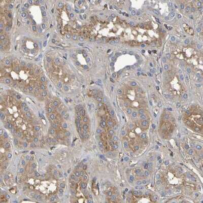 Immunohistochemistry-Paraffin: GAB3 Antibody [NBP1-86111] - Staining of human kidney shows moderate cytoplasmic positivity in cells in tubules.