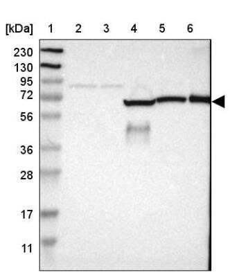 Western Blot: GAB3 Antibody [NBP1-86111] - Lane 1: Marker  [kDa] 230, 130, 95, 72, 56, 36, 28, 17, 11.  Lane 2: Human cell line RT-4.  Lane 3: Human cell line U-251MG sp.  Lane 4: Human plasma (IgG/HSA depleted).  Lane 5: Human liver tissue.  Lane 6: Human tonsil tissue