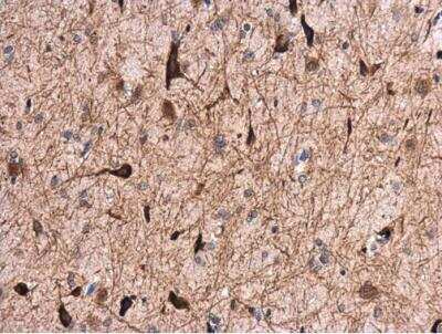 Immunohistochemistry-Paraffin: GABA-A R alpha 1 Antibody [NBP2-16565] - Paraffin-embedded rat brain. GABA A Receptor alpha 1 antibody [N1C1] diluted at 1:500.