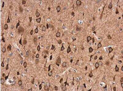 Immunohistochemistry-Paraffin: GABA-A R alpha 1 Antibody [NBP2-16565] - Paraffin-embedded rat brain. GABA A Receptor alpha 1 antibody [N1C1] diluted at 1:500.