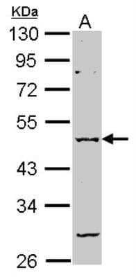 Western Blot: GABA-A R alpha 2 Antibody [NBP2-16566] - Sample (30 ug of whole cell lysate) A: NT2D1 10% SDS PAGE gel, diluted at 1:1000.