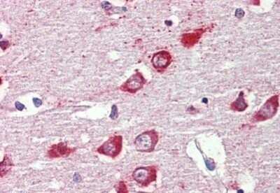 Immunohistochemistry-Paraffin: GABA A R alpha 3 Antibody [NBP1-52391] - Analysis of anti-GABRA3 antibody with human brain, cortex at concentration 2.5 ug/ml.