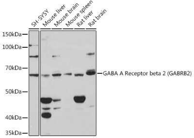 Western Blot GABA-A R beta 2 Antibody (6G9O8)