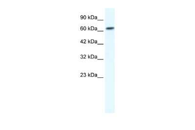 Western Blot: GABA-A R beta 2 Antibody [NBP2-82224] - WB Suggested Anti-GABRB2 Antibody Titration: 1.25ug/ml. ELISA Titer: 1:62500. Positive Control: Jurkat cell lysate