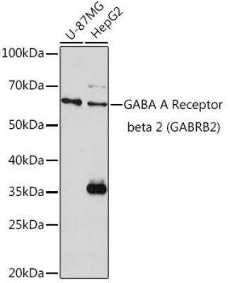 Western Blot: GABA-A R beta 2 Antibody [NBP3-03626] - Analysis of extracts of various cell lines, using GABA A Receptor beta 2 (GABA A Receptor beta 2 (GABRB2)) Rabbit pAb at 1:1000 dilution. Secondary antibody: HRP Goat Anti-Rabbit IgG (H+L) at 1:10000 dilution. Lysates/proteins: 25ug per lane. Blocking buffer: 3% nonfat dry milk in TBST. Detection: ECL Basic Kit. Exposure time: 180s.
