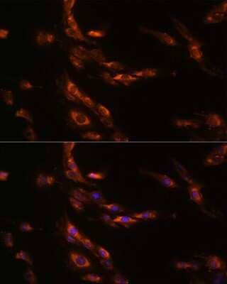 Immunocytochemistry/Immunofluorescence: GABA-A R gamma 1 Antibody [NBP3-03553] - Immunofluorescence analysis of C6 cells using GABA-A R gamma 1 Rabbit pAb (NBP3-03553) at dilution of 1:100 (40x lens). Blue: DAPI for nuclear staining.