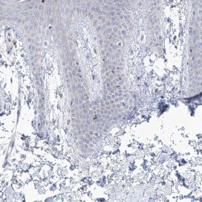 Immunohistochemistry-Paraffin: GABA-A R gamma 1 Antibody [NBP1-91003] - Staining of human Skin shows no positivity in squamous epithelial cells as expected.