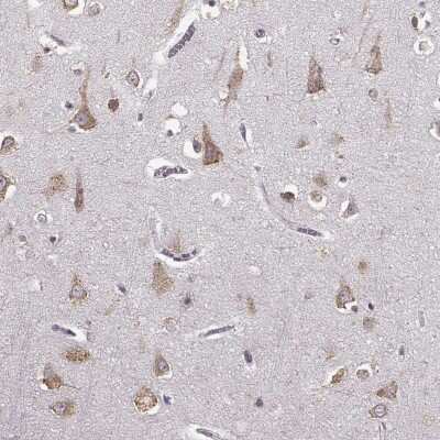 Immunohistochemistry-Paraffin: GABA-A R gamma 3 Antibody [NBP2-30464] - Staining of human cerebral cortex shows moderate cytoplasmic positivity in neuronal cells.