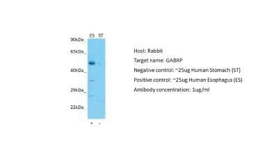 Western Blot GABA-A R pi Antibody