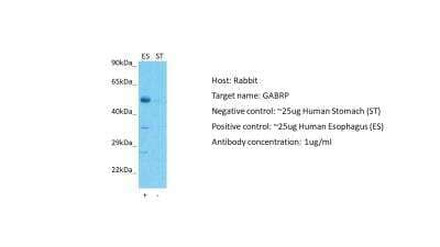 Western Blot: GABA-A R pi Antibody [NBP2-84036] - Host: Rabbit. Target: GABRP. Positive control (+): Human esophagus (ES). Negative control (-): Human stomach (ST). Antibody concentration: 1ug/ml