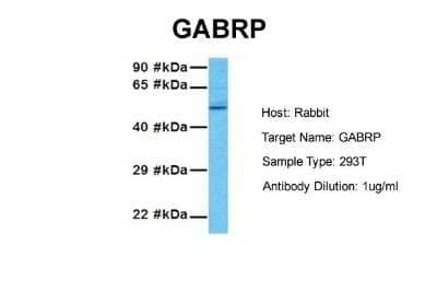 Western Blot: GABA-A R pi Antibody [NBP2-84037] - Host: Rabbit. Target Name: GABRP. Sample Tissue: Human 293T. Antibody Dilution: 1.0ug/ml
