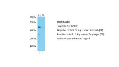 Western Blot: GABA-A R pi Antibody [NBP2-84037] - Host: Rabbit. Target: GABRP. Positive control (+): Human esophagus (ES). Negative control (-): Human stomach (ST). Antibody concentration: 1ug/ml