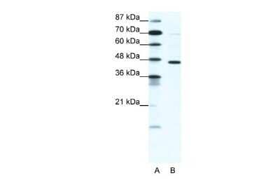 Western Blot: GABA-A R pi Antibody [NBP2-84037] - WB Suggested Anti-GABRP Antibody. Titration: 1.25 ug/ml. Positive Control: HepG2/Jurkat