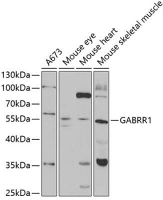 Western Blot: GABA-A R rho 1 Antibody [NBP3-03696] - Analysis of extracts of various cell lines, using GABA-A R rho 1 antibody at 1:1000 dilution. Secondary antibody: HRP Goat Anti-Rabbit IgG (H+L) at 1:10000 dilution. Lysates/proteins: 25ug per lane. Blocking buffer: 3% nonfat dry milk in TBST.