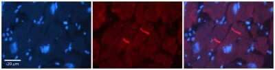 Immunohistochemistry: GABA-A R rho 2 Antibody [NBP1-80061] - Human Adult heart Observed Staining: Membrane (tight junctions - intercalated disks) Primary Antibody Concentration: 1 : 600 Secondary Antibody: Donkey anti-Rabbit-Cy2/3 Secondary Antibody Concentration: 1 : 200 Magnification: 20X Exposure Time: 0.5 2.0 s