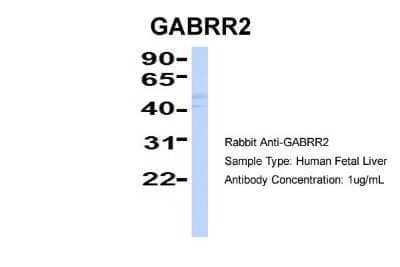 Western Blot GABA-A R rho 2 Antibody