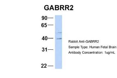 Western Blot: GABA-A R rho 2 Antibody [NBP1-80061] - Sample Type: Human Fetal Brain Antibody Dilution: 1.0 ug/ml