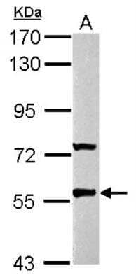 Western Blot: GABA-A R rho 2 Antibody [NBP2-16573] -  Sample (30 ug of whole cell lysate) A: Neuro2A 7. 5% SDS PAGE gel, diluted at 1:1000.