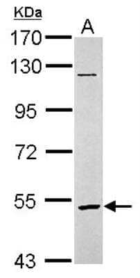 Western Blot: GABA-A R rho 2 Antibody [NBP2-16573] -  Sample (30 ug of whole cell lysate) A: SK-N-SH 7. 5% SDS PAGE gel, diluted at 1:3000.
