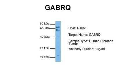 Western Blot: GABA-A R theta Antibody [NBP1-80078] - Sample Tissue: Human Stomach Tumor Antibody Dilution: 1.0 ug/ml