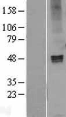 Western Blot GABA-AR alpha 1 Overexpression Lysate