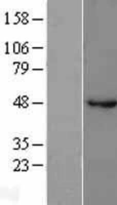 Western Blot: GABA A Receptor beta 1 Overexpression Lysate (Adult Normal) [NBL1-10920] Left-Empty vector transfected control cell lysate (HEK293 cell lysate); Right -Over-expression Lysate for GABA A Receptor beta 1.